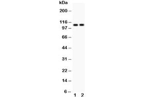 Western blot testing of ATP2A1 antibody and Lane 1:  rat skeletal muscle (ATP2A1/SERCA1 Antikörper  (N-Term))