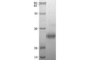 Western Blotting (WB) image for Kallikrein 6 (KLK6) (Transcript Variant B) protein (His tag) (ABIN2724329)