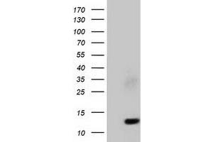 Western Blotting (WB) image for anti-Follicle Stimulating Hormone, beta Polypeptide (FSHB) antibody (ABIN1498318)