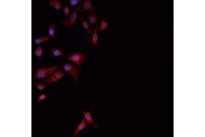ABIN6274061 staining NCI-H1299 cells by ICC/IF. (Dynamin 1-Like Antikörper  (pSer637))