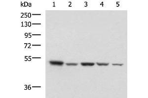 Western blot analysis of HepG2 NIH/3T3 C2CL2 Raji and Jurkat cell lysates using ENO3 Polyclonal Antibody at dilution of 1:1000 (ENO3 Antikörper)