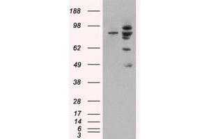 Image no. 2 for anti-Mdm2, p53 E3 Ubiquitin Protein Ligase Homolog (Mouse) (MDM2) (Internal Region) antibody (ABIN374627)