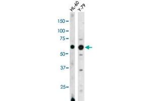 The RAD9A (phospho S328) polyclonal antibody  is used in Western blot to detect Phospho-RAD9A-S328 in HL-60 (left) and Y-79 (right) cell lysates