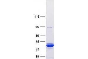 Western Blotting (WB) image for Superoxide Dismutase 2, Mitochondrial (SOD2) (Transcript Variant 2) protein (Myc-DYKDDDDK Tag) (ABIN2732997)