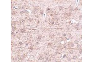 Immunohistochemistry of ZBTB1 in mouse brain tissue with this product at 2. (ZBTB1 Antikörper  (Center))