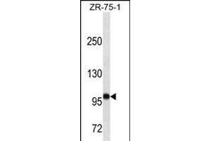 FUT4 Antibody (ABIN1539891 and ABIN2843850) western blot analysis in ZR-75-1 cell line lysates (35 μg/lane). (CD15 Antikörper  (AA 425-454))