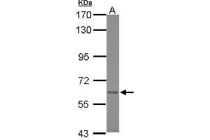 WB Image Sample (30 ug of whole cell lysate) A: A431 7. (Asparagine Synthetase Antikörper)