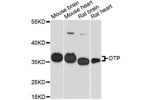 Western blot analysis of extracts of various cell lines, using OTP antibody. (OTP Antikörper)