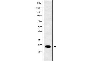 Western blot analysis of RPL29 using COLO205 whole cell lysates (RPL29 Antikörper  (Internal Region))