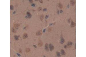 IHC-P analysis of Rat Tissue, with DAB staining. (NPPC Antikörper  (AA 31-126))