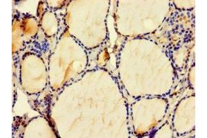 anti-Zinc Finger, Matrin-Type 4 (ZMAT4) (AA 1-153) antibody