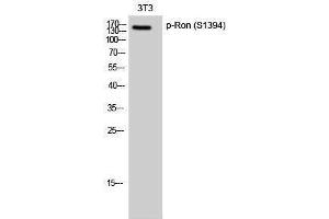 Western Blotting (WB) image for anti-Macrophage Stimulating 1 Receptor (C-Met-Related tyrosine Kinase) (MST1R) (pSer1394) antibody (ABIN3173035) (MST1R Antikörper  (pSer1394))