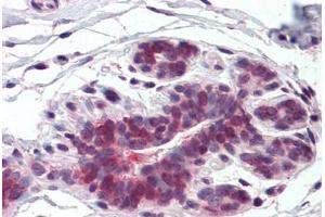 Anti-ELOVL5 antibody  ABIN960769 IHC staining of human breast. (ELOVL5 Antikörper  (Internal Region))
