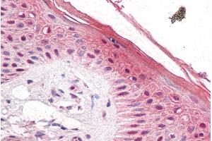 ABIN184855 (5µg/ml) staining of paraffin embedded Human Skin. (PUF60 Antikörper  (C-Term))