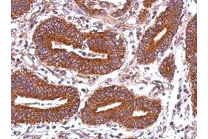 Immunohistochemistry (IHC) image for anti-Major Histocompatibility Complex, Class II, DQ beta 2 (HLA-DQB2) antibody (ABIN2855831)