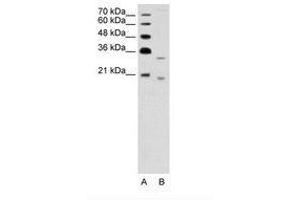 DNASE2B Antikörper  (AA 47-96)