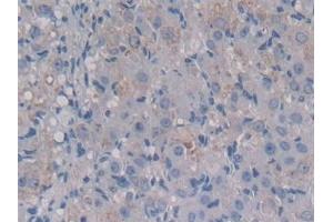 Detection of MCSF in Mouse Ovary Tissue using Polyclonal Antibody to Colony Stimulating Factor 1, Macrophage (MCSF) (M-CSF/CSF1 Antikörper  (AA 33-204))