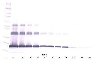Image no. 1 for anti-Tumor Necrosis Factor (Ligand) Superfamily, Member 11 (TNFSF11) antibody (ABIN465771) (RANKL Antikörper)