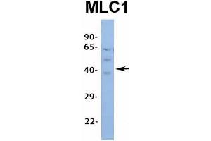 Host:  Rabbit  Target Name:  MLC1  Sample Type:  Human Fetal Spleen  Antibody Dilution:  1. (MLC1 Antikörper  (Middle Region))
