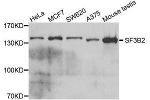 Western blot analysis of extracts of various cell lines, using SF3B2 antibody. (SF3B2 Antikörper  (AA 616-895))