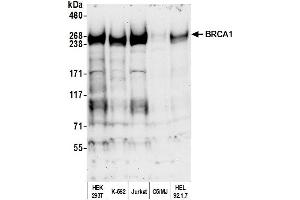Western Blotting (WB) image for anti-Breast Cancer 1 (BRCA1) (C-Term) antibody (ABIN7449672)