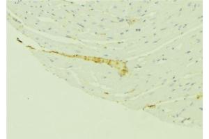 ABIN6276410 at 1/100 staining Mouse liver tissue by IHC-P. (VDAC1 Antikörper  (C-Term))