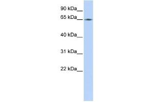 WB Suggested Anti-LMNB2 Antibody Titration:  0. (Lamin B2 Antikörper  (Middle Region))