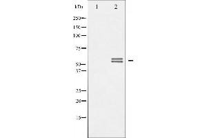 Western blot analysis of Lyn phosphorylation expression in H2O2 treated K562 whole cell lysates,The lane on the left is treated with the antigen-specific peptide. (LYN Antikörper  (pTyr507))