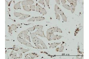 Image no. 1 for anti-Non-SMC Condensin I Complex, Subunit G (NCAPG) (AA 336-435) antibody (ABIN599293) (NCAPG Antikörper  (AA 336-435))