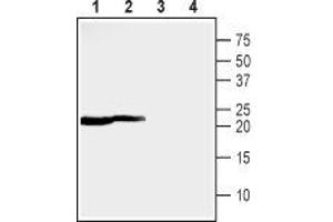 Western blot analysis of rat (lanes 1 and 3) and mouse (lanes 2 and 4) heart lysates: - 1,2. (MMGT1 Antikörper  (C-Term, Intracellular))