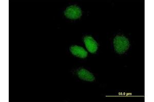 Immunofluorescence of purified MaxPab antibody to ATF2 on HeLa cell. (ATF2 Antikörper  (AA 1-209))
