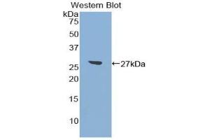 Detection of Recombinant ATF7, Mouse using Polyclonal Antibody to Activating Transcription Factor 7 (ATF7) (AFT7 Antikörper  (AA 50-270))