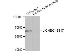 Western blot analysis of extracts of MCF7 cell line, using Phospho-CHEK1-S317 antibody. (CHEK1 Antikörper  (pSer317))