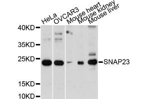 Western blot analysis of extracts of various cell lines, using SNAP23 antibody. (SNAP23 Antikörper)