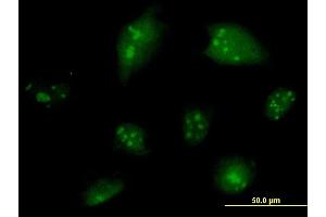Immunofluorescence of monoclonal antibody to NCOA6 on HeLa cell.