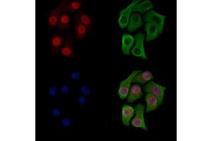 ABIN6266225 and ABIN6277496 staining Hela cells(heat shock treatment) by IF/ICC. (Histone 3 Antikörper  (H3K14me2))