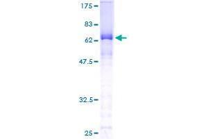 CTNNA3 Protein (AA 1-376) (GST tag)