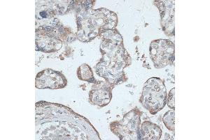 Immunohistochemistry of paraffin-embedded human placenta using PMEP antibody (6555) at dilution of 1:100 (40x lens). (PMEPA1 Antikörper  (AA 173-252))