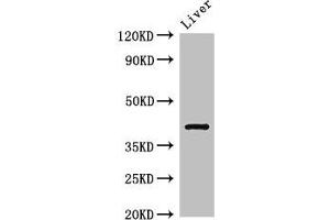 Western Blot Positive WB detected in: Rat liver tissue All lanes: TGDS antibody at 3 μg/mL Secondary Goat polyclonal to rabbit IgG at 1/50000 dilution Predicted band size: 41 kDa Observed band size: 41 kDa (TGDS Antikörper  (AA 143-305))
