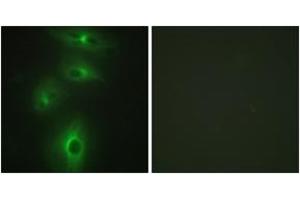 Immunofluorescence analysis of HeLa cells, using TMPRSS3 Antibody. (TMPRSS3 Antikörper  (AA 405-454))