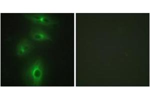 Immunofluorescence analysis of HeLa cells, using TMPRSS3 Antibody.