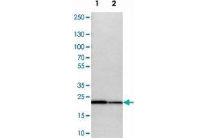 Western blot analysis of cell lysates with SPCS2 polyclonal antibody  at 1:250-1:500 dilution. (SPCS2 Antikörper)
