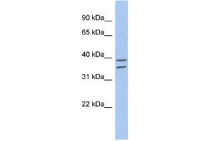 WB Suggested Anti-ZADH2 Antibody Titration: 0.
