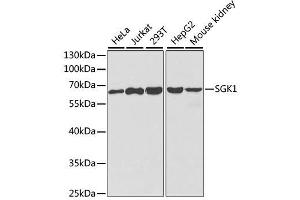 Western blot analysis of extracts of various cell lines, using SGK1 antibody. (SGK1 Antikörper  (AA 172-431))