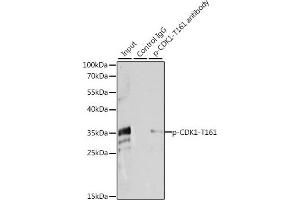 Immunoprecipitation analysis of 200 μg extracts of HeLa cells, using 3 μg Phospho-CDK1-T161 pAb (ABIN3020135, ABIN3020136, ABIN3020137, ABIN1681454 and ABIN6225511). (CDK1 Antikörper  (pThr161))