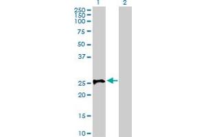 Western Blot analysis of STX1A expression in transfected 293T cell line by STX1A MaxPab polyclonal antibody. (STX1A Antikörper  (AA 1-251))