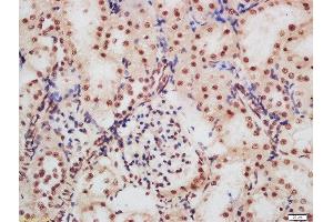 Formalin-fixed and paraffin embedded rat kidney labeled with Rabbit Anti-CDKN1A (Ser130) Polyclonal Antibody, Unconjugated  at 1:200 followed by conjugation to the secondary antibody and DAB staining (p21 Antikörper  (pSer130))
