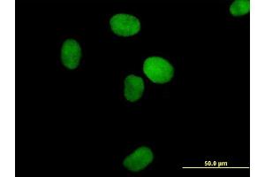 Immunofluorescence of purified MaxPab antibody to XRCC4 on HeLa cell. (XRCC4 Antikörper  (AA 1-336))