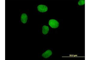 Immunofluorescence of purified MaxPab antibody to XRCC4 on HeLa cell.