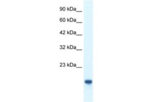 Western Blotting (WB) image for anti-C-Myc Binding Protein (MYCBP) antibody (ABIN2460299) (MYCBP Antikörper)